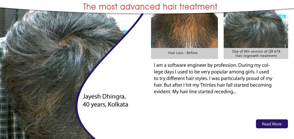 QR 678 Neo Hair Fall and Hair Regrowth Therapy has received the US and  Indian Patent and is Indian FDA approved  The News Strike